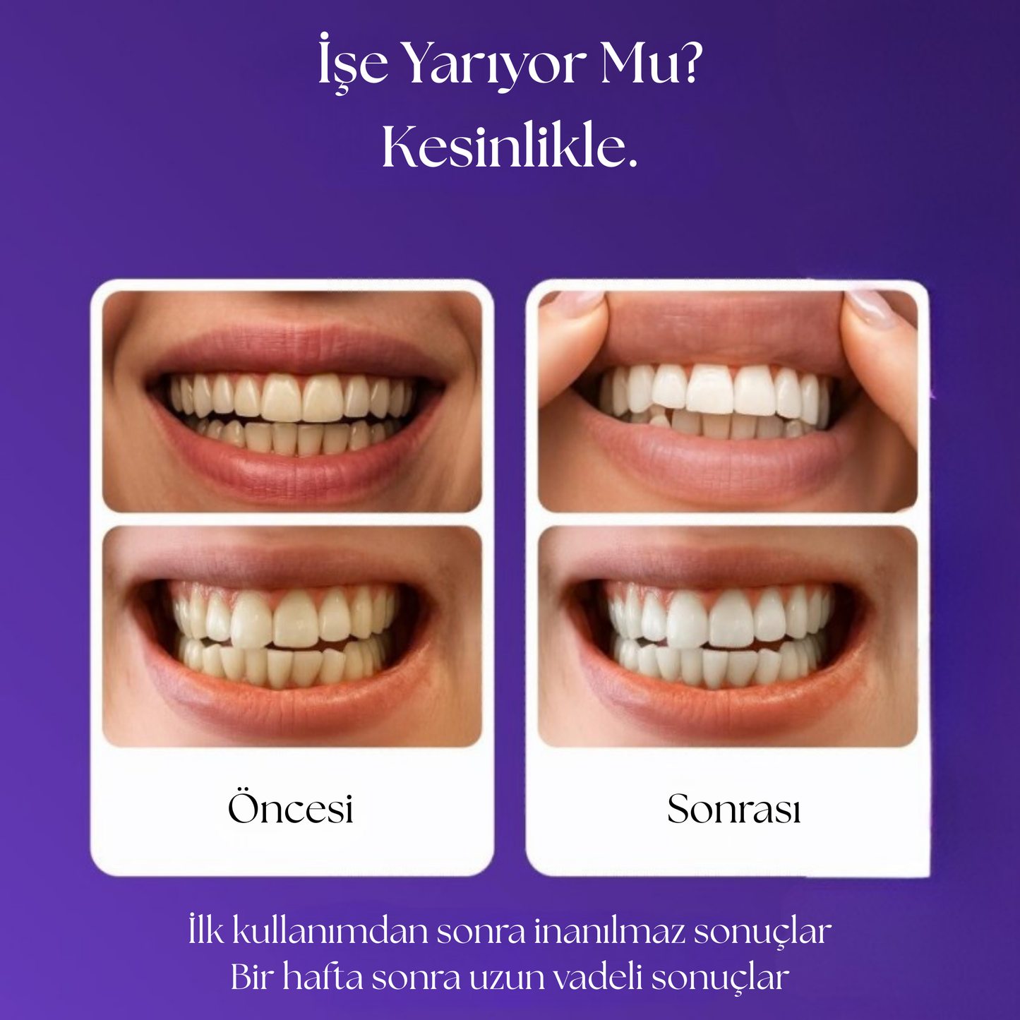 WHİTİQPRO™Beyazlatıcı Bantlar