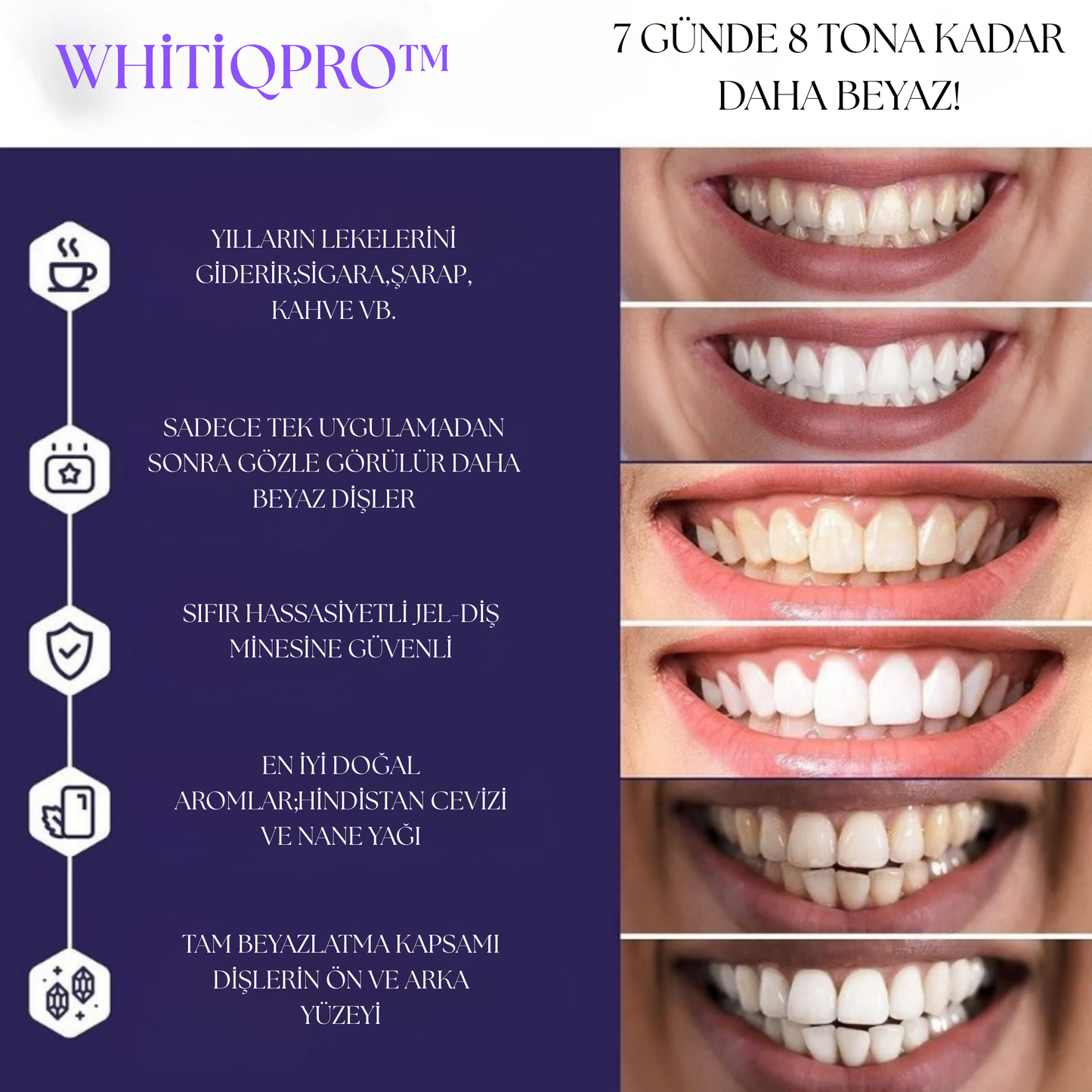 WHİTİQPRO™Beyazlatıcı Bantlar