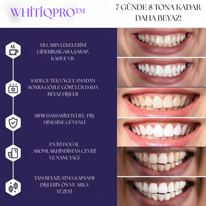 WHİTİQPRO™Beyazlatıcı Bantlar